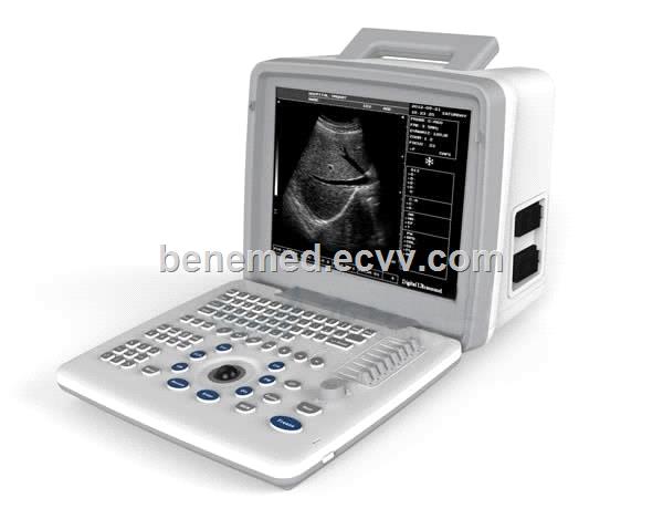 Portable Black White Ultrasound Scanner BW5 with 12 Inch LED Screen Two Probe Connector