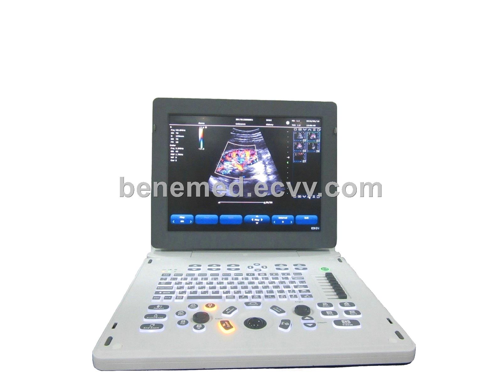 Portable Color doppler Ultrasound scanner BENE5 2D echo cardiac