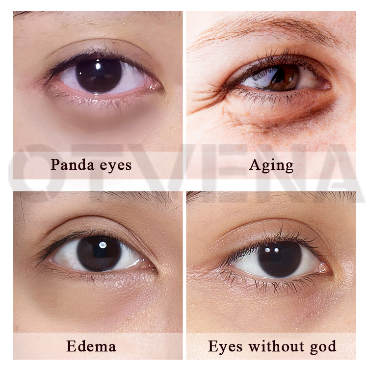 OTVENA OEMODM 3ML Antiwrinkle eye bag removing whitening eye cream