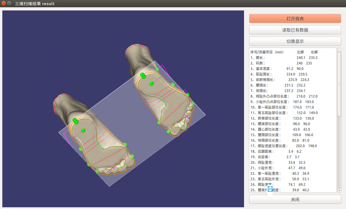 3D intelligent foot scanner complete output STL model files calculate more than 50 items of foot data