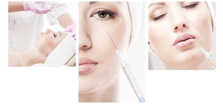 TOPQ Super Derm Line 2CC 100 hyaluronic acid dermal fillers for lip augmentation