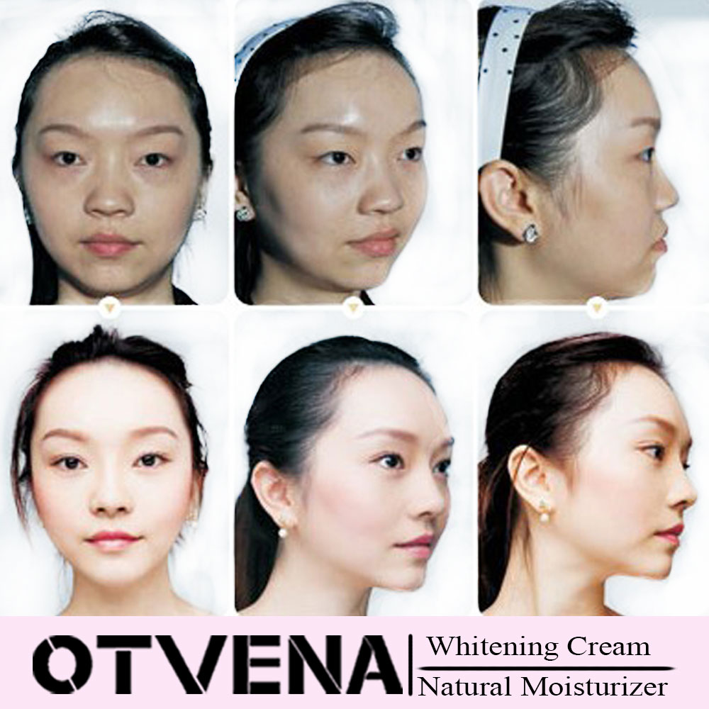 Best face moisturizer OTVENA Whitening Moisturizing Cream for skin care