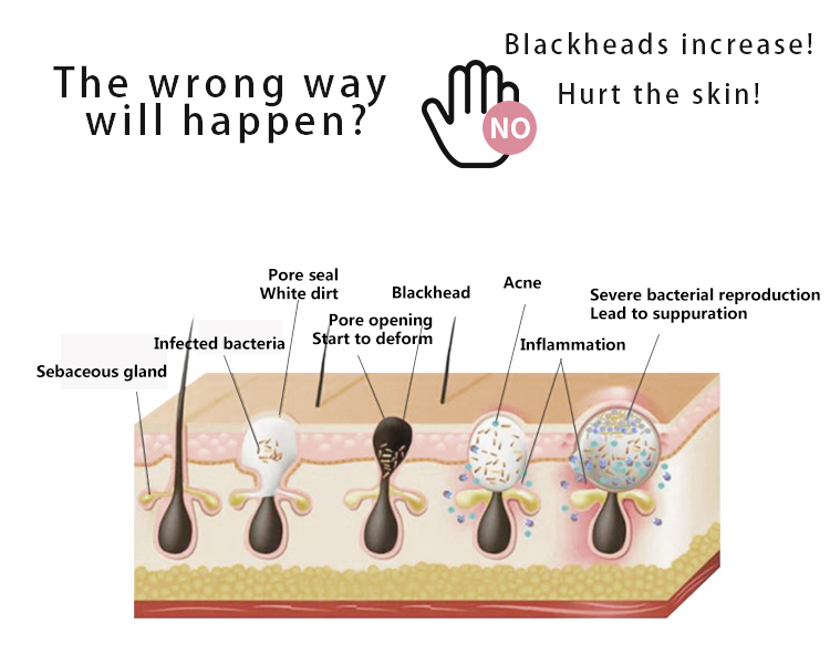New design ultrasonic skin scrubberskin spatula