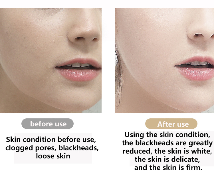 New design ultrasonic skin scrubberskin spatula