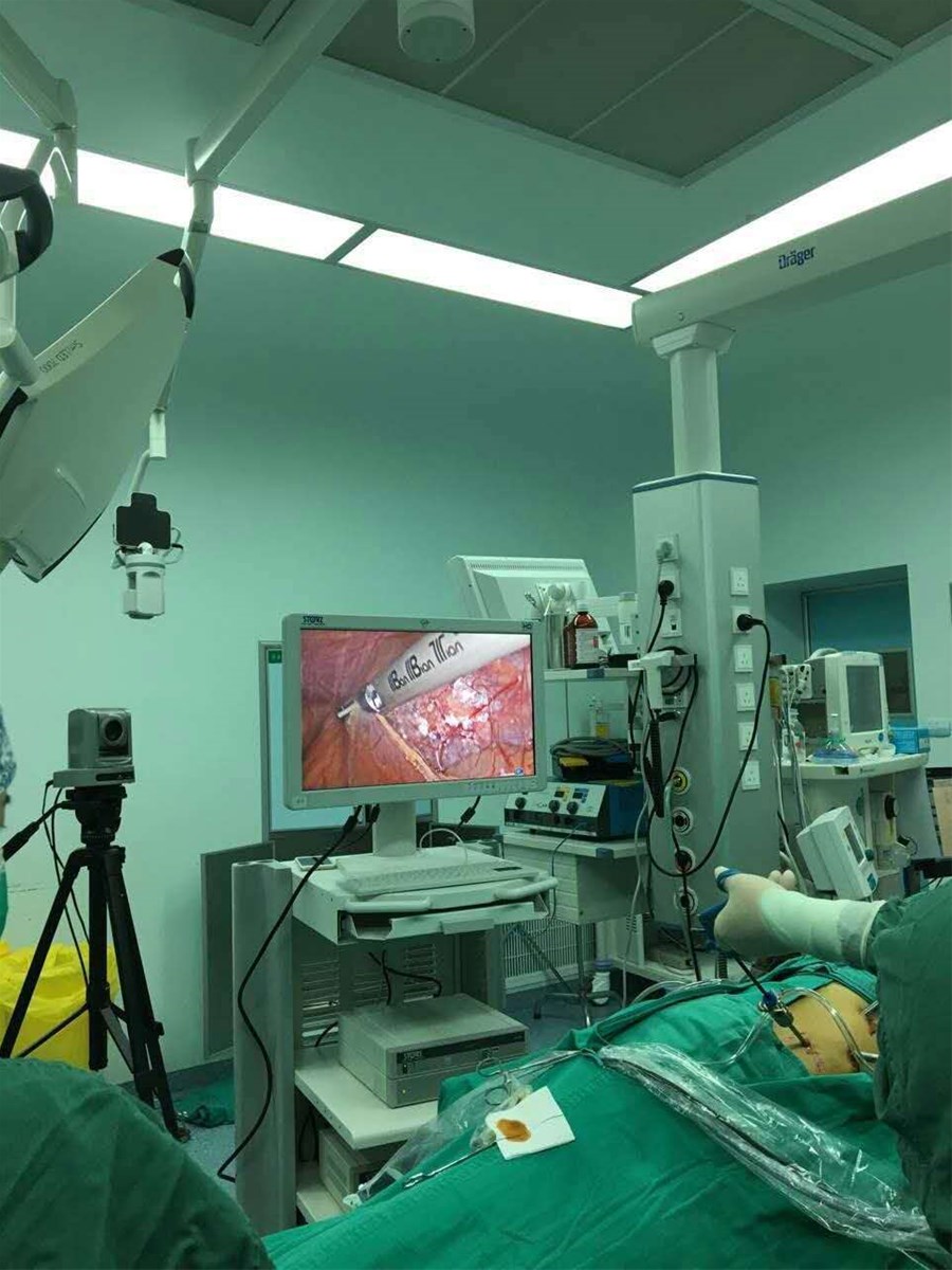 Medical equipment Harmonic surgery system used in laparoscopy minimally surgery