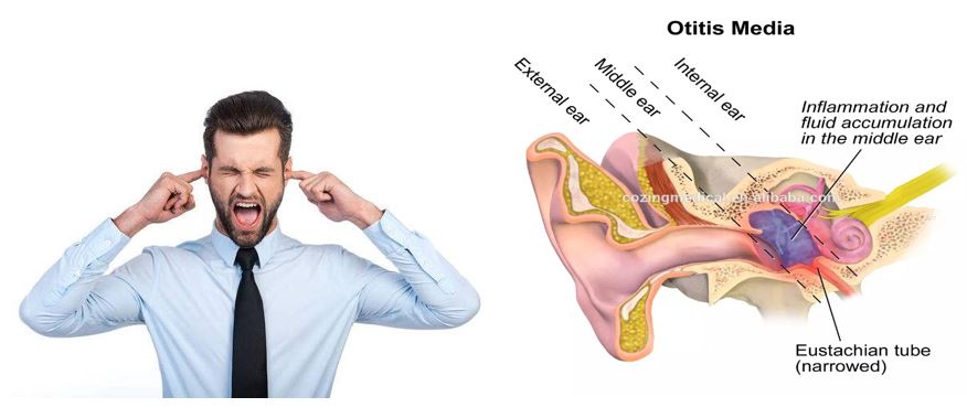 Ear acupuncture Tinnitus Physiotherapy Laser Therapy Apparatus