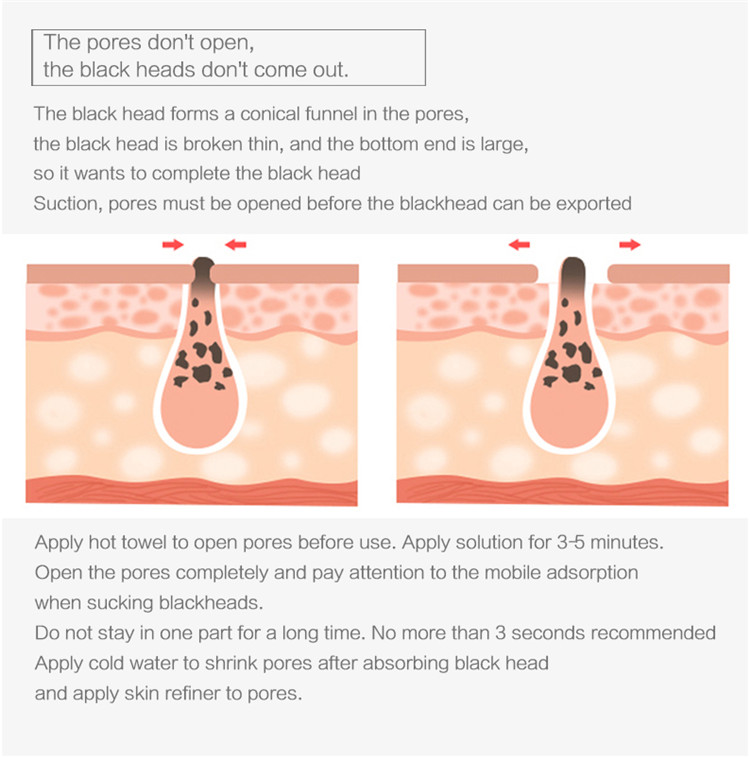 New product ideas 2019 make up salon skin care beauty equipment acne remover vacuum blackhead remover