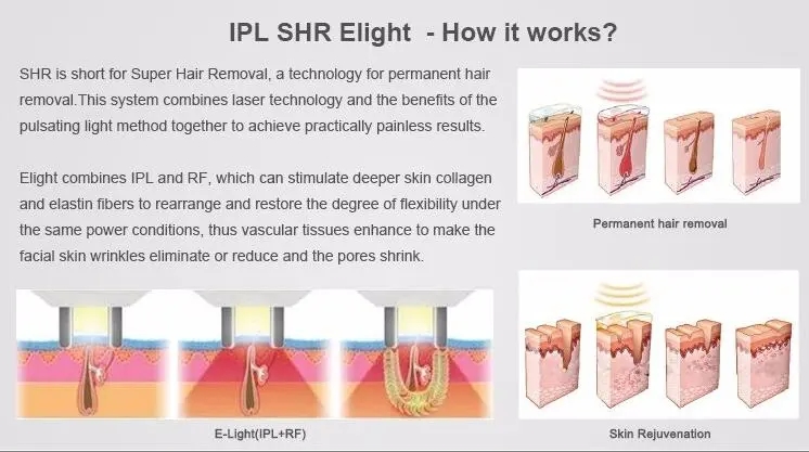 IPL Shr Opt Laser Hair Removal Medical Equipment Beauty Machine