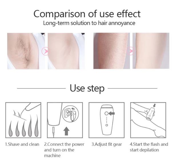 Portable household IPL laser hair removal 2020