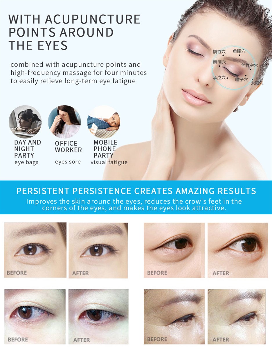 Electronic face beauty device antiwrinkle with hot and cold vibration photon therapy