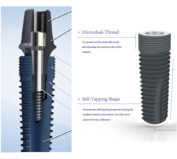 Regular Diameter Titanium Dental Implant Microthread Bone Level Tapered Dental Fixture Factory OEM Surgical Teeth Dentu