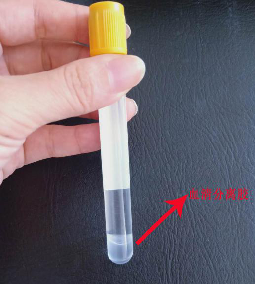 Classification of vacuum blood collection tubes principle and function of additives