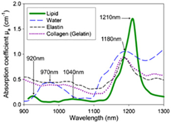 What Is Endovenous Laser Ablation EVLA 1470nm wavelength laser