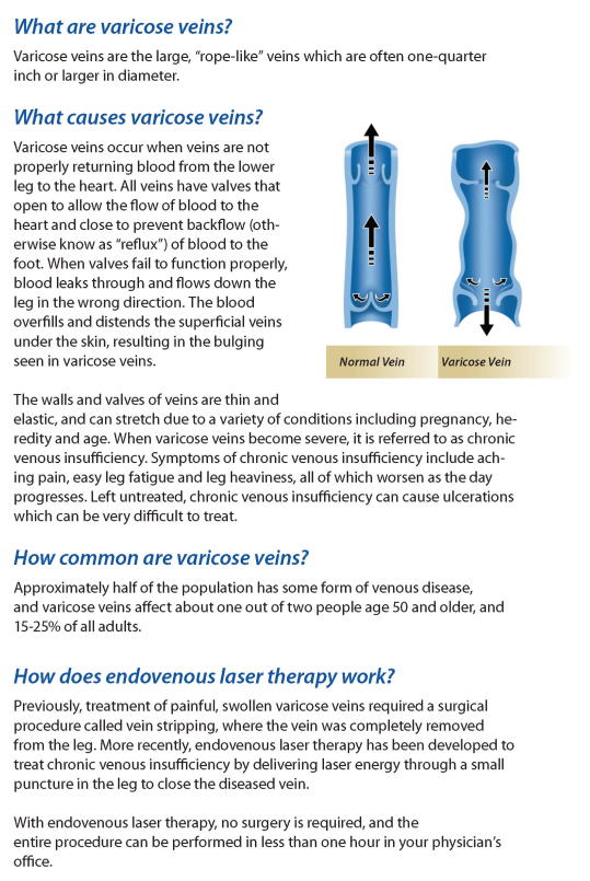 EVLT Endovenous laser treatment 1470nm980nm laser for minimaly invisave treatment