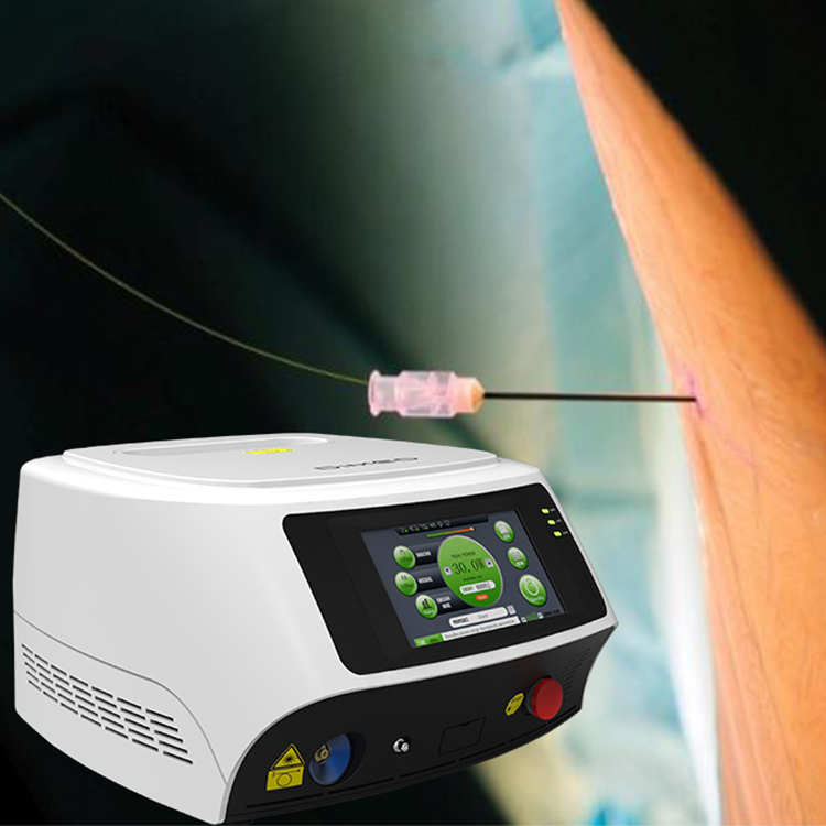 CHERYLAS LASER for minimallyinvasive medical procedure PLDD