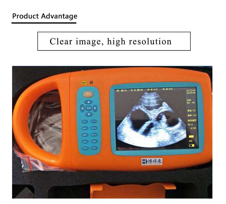 Boxianglai Veterinary Scanners BXLM3 Pig Sheep VET ULTRASOUND 56 Inch Ultrasound Equipment