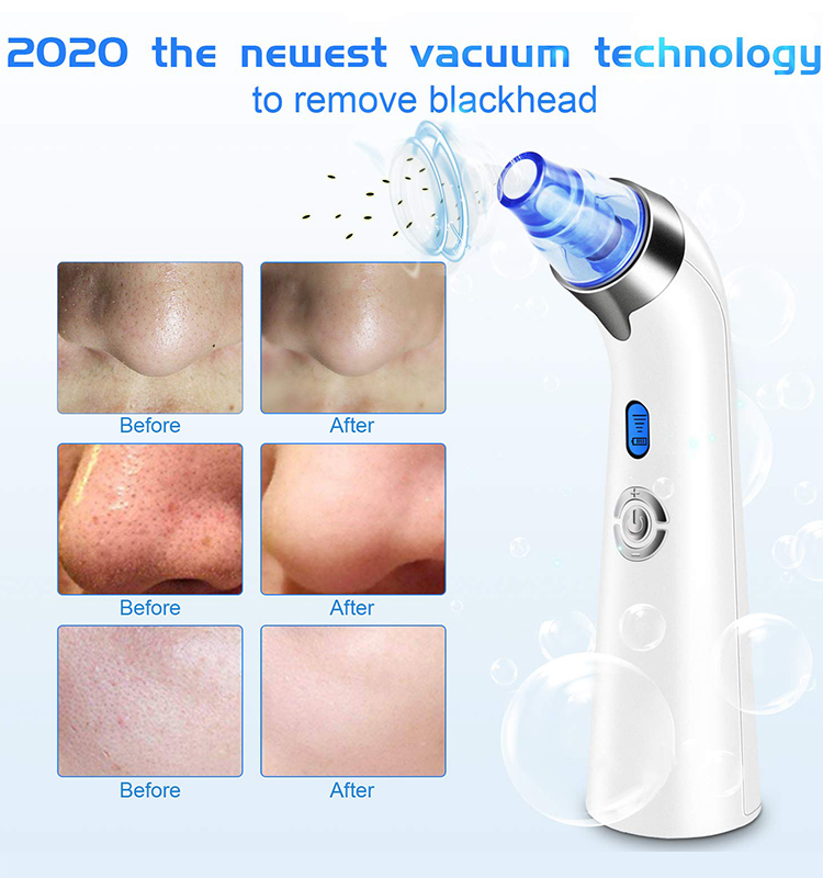 2021 Newest Blackhead Remover Pore Vacuum Electric Acne Comedone Whitehead Extractor Tool with 5 Suction Power