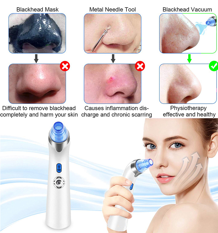 2021 Newest Blackhead Remover Pore Vacuum Electric Acne Comedone Whitehead Extractor Tool with 5 Suction Power