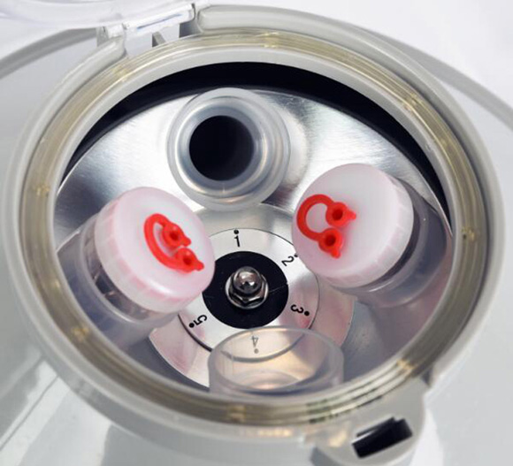 Spin Centrifuge Medical with Timer Speed Control Details 4000rpm XC2000