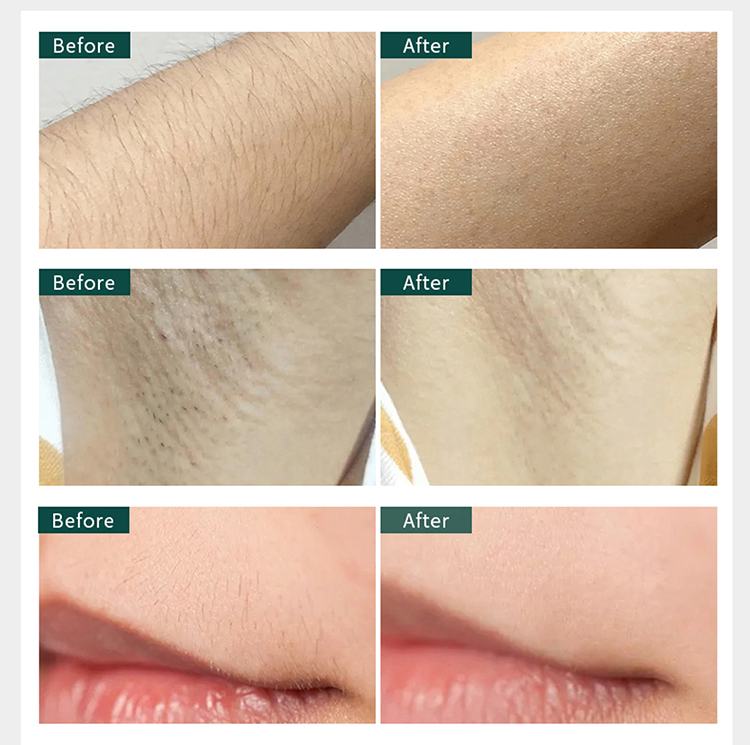 2021 New IPL High Quality Woman Home Use Painless Portable Beauty Device Portable Easy Use Depilador