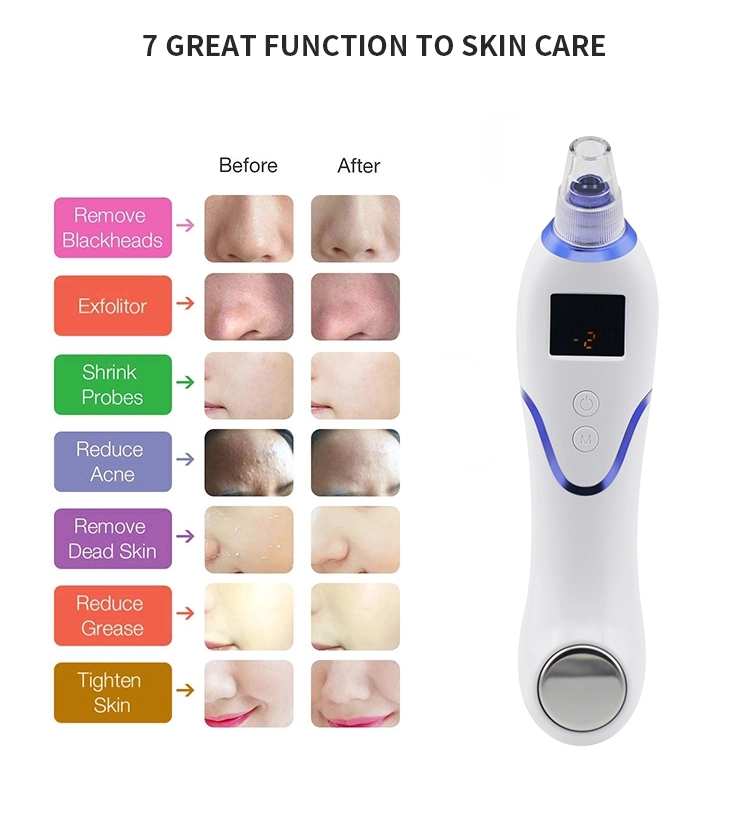 Black Head Removal Vacuum Suction Removal Cool System Massager Facial Machine Face Care