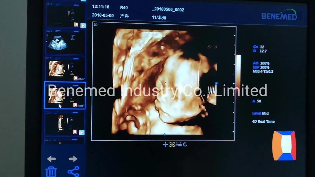 4D Color Doppler Ultrasound Scanner with Touch Screen