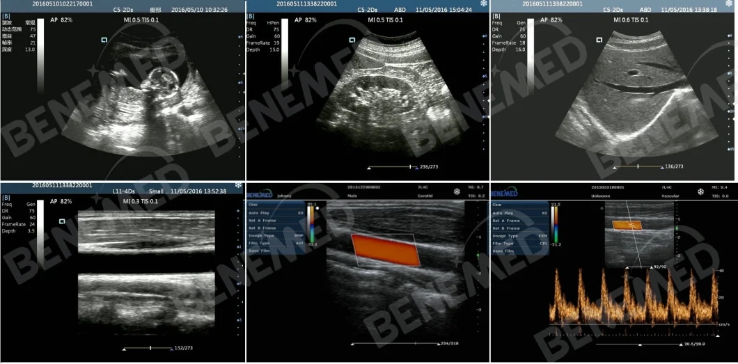 Laptop Type Color Doppler Ultrasound Scanner Clear Qualtiy Image