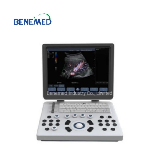 Laptop Type Color Doppler Ultrasound Scanner Clear Qualtiy Image