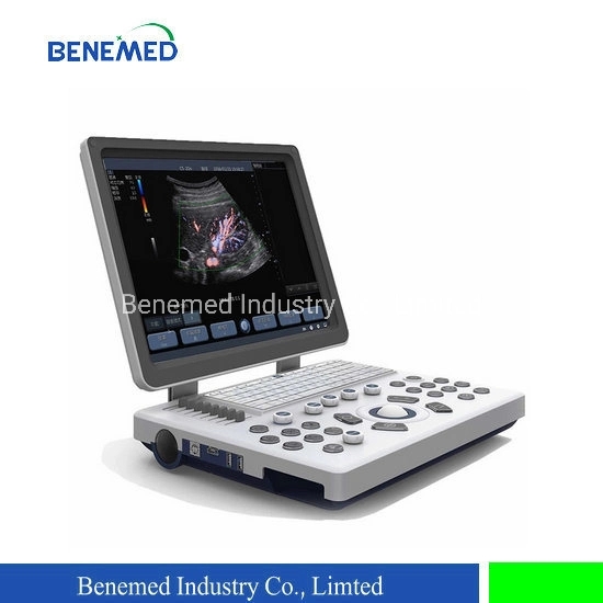 Laptop Type Color Doppler Ultrasound Scanner Clear Qualtiy Image