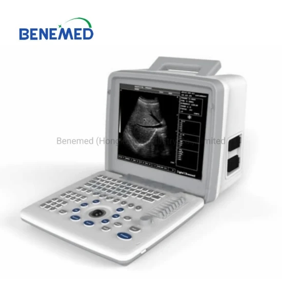 Portable BW Ultrasound Scanner with Clear Image Quality