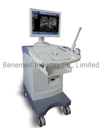 Trolly Buildin Black and White Ultrasound Scanner Diagnostic Equipment