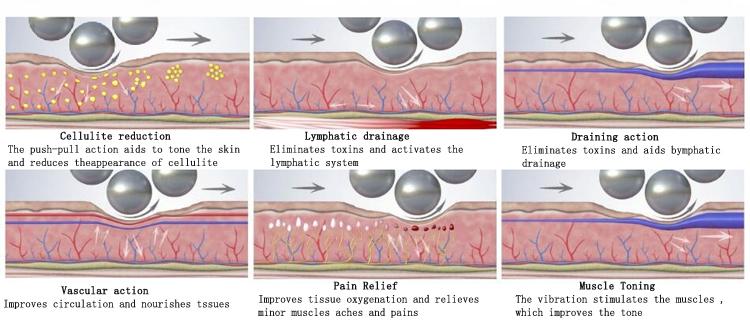 6d Roller Endospheres Therapy Anti Cellulite Endospheres Inner Ball Roller Endos Slimming Machine