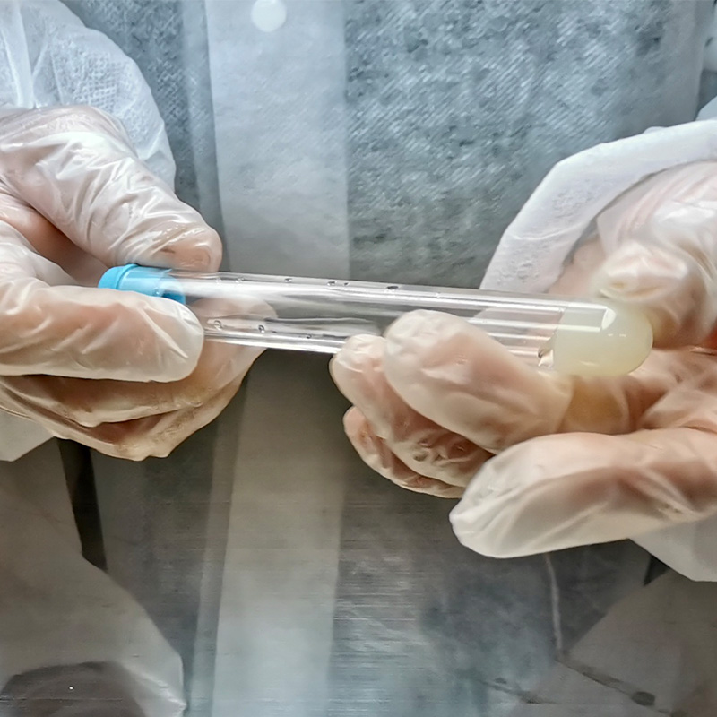 Platelet Rich Plasma Tube ACD and Gel 10ml