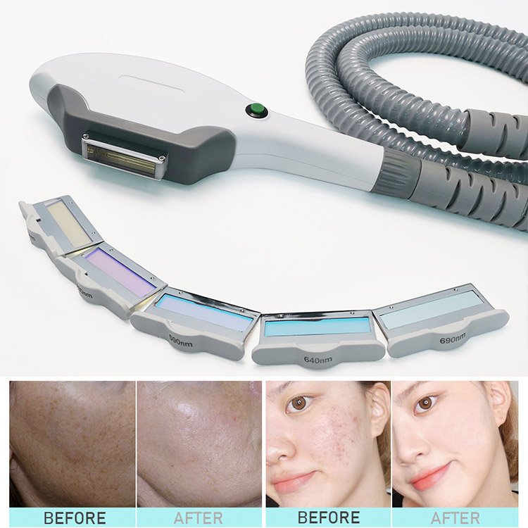 Multifunction diode laser IPL opt elight Q switch Nd yag laser RF radio frequency beauty machine