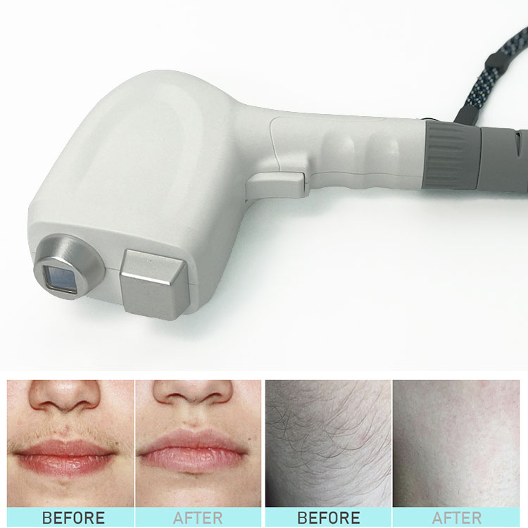 Multifunction diode laser IPL opt elight Q switch Nd yag laser RF radio frequency beauty machine