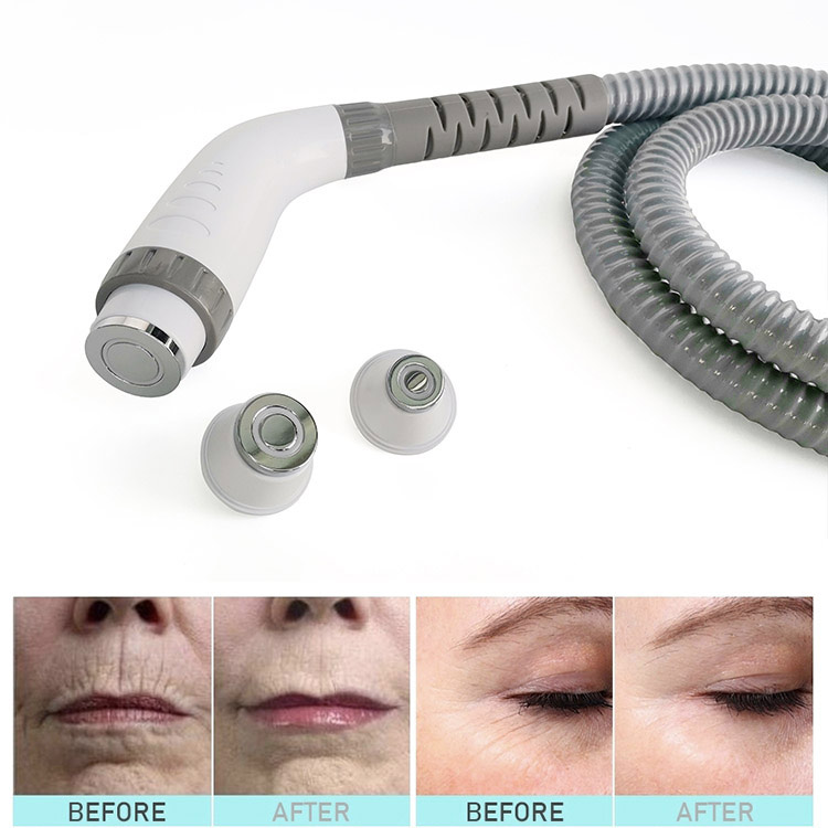 Multifunction diode laser IPL opt elight Q switch Nd yag laser RF radio frequency beauty machine