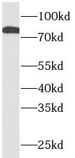 anti STAT1 antibody ISGF 3 STAT1 STAT91