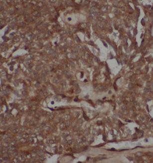 anti STAT1 antibody ISGF 3 STAT1 STAT91