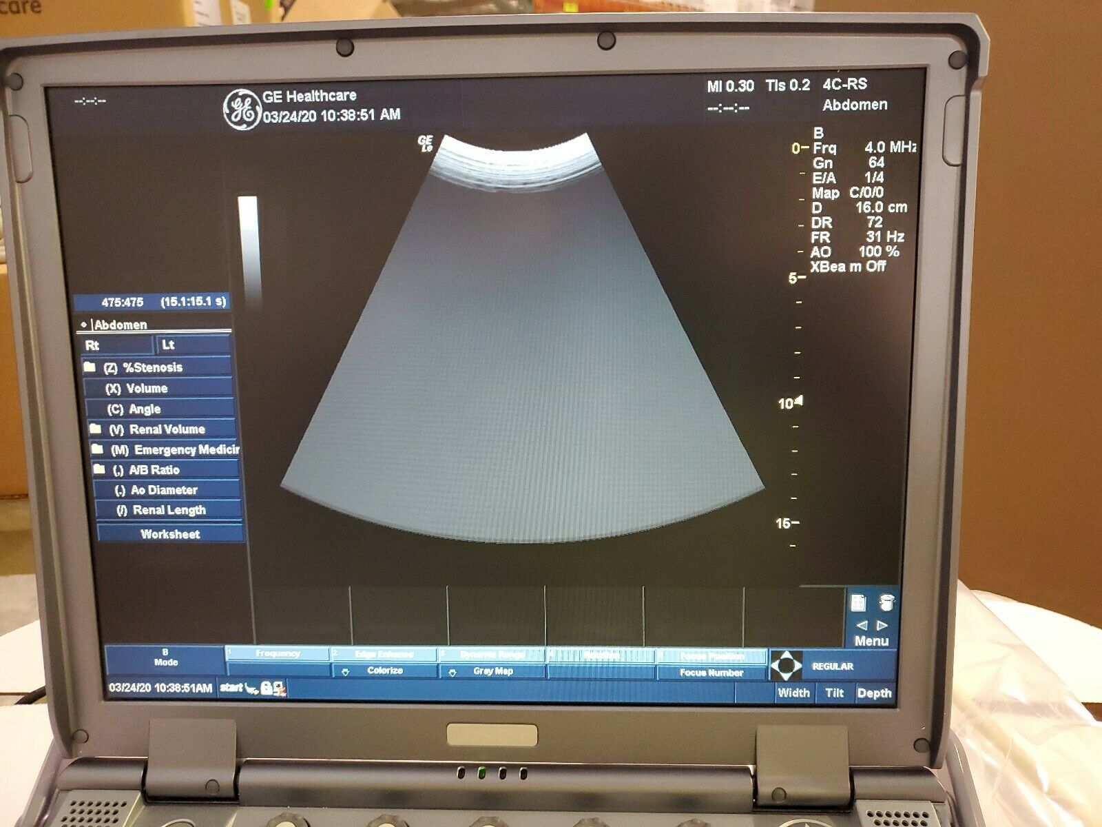 GE Logiq e BT09 Portable Ultrasound System 2 PROBES E8CRS4CRS