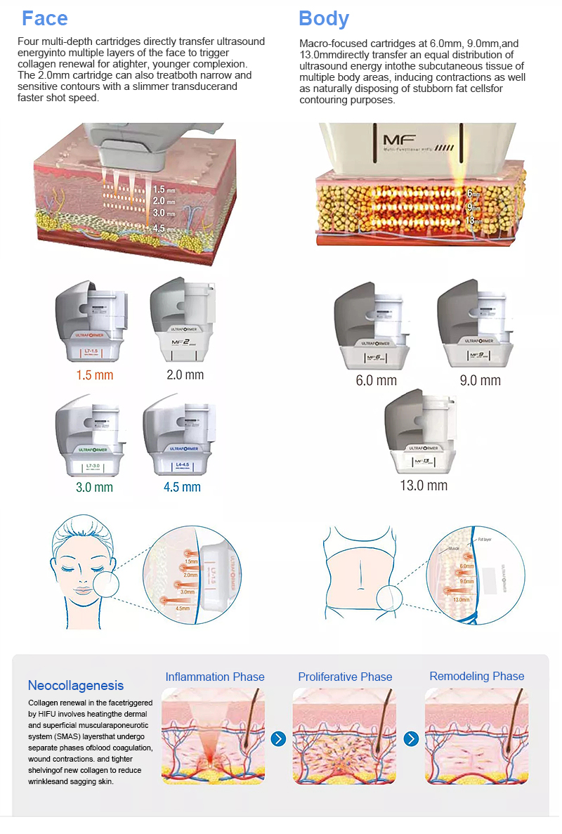 7D Plus ultraformer machine for Face Lifting Winkle Removal on Sale