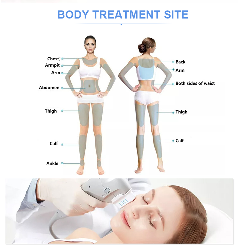7D Plus ultraformer machine for Face Lifting Winkle Removal on Sale
