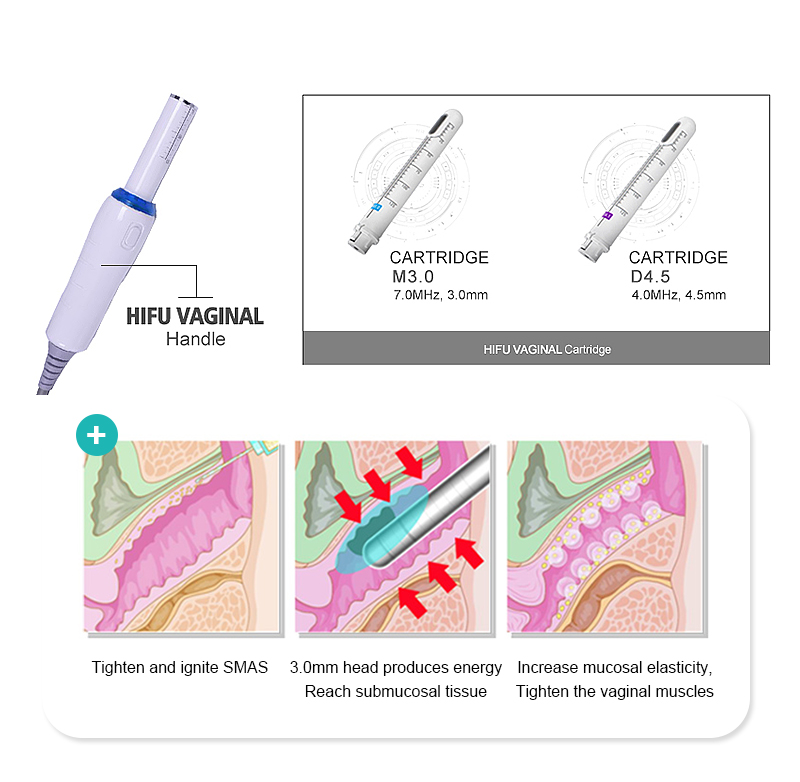 7D UltroformerIII Vaginal HIFU for FaceBody and Vaginal Machine