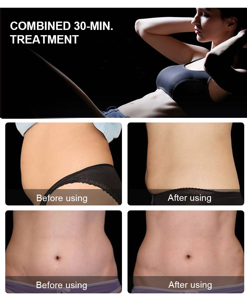Aesthetics EMT Slimming Machine 4 Handles Body Sculpt EMSlim NEO With RF