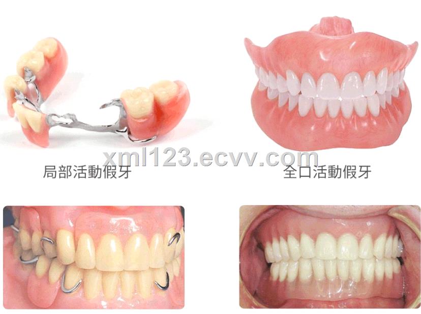 Implant Dental Laboratory in China Emax Chinese Dental Lab