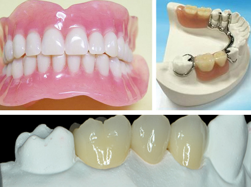 Realistic Digital Data OEM 3D Printed Dental Models For Dentist Study