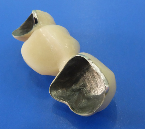 UltraTranslucent Zirconia China dental zirconia crowns