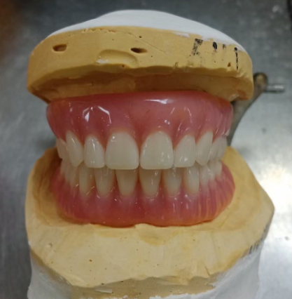 REMOVABLES DENTURES Dental Pfm Crown From China Dental Lab