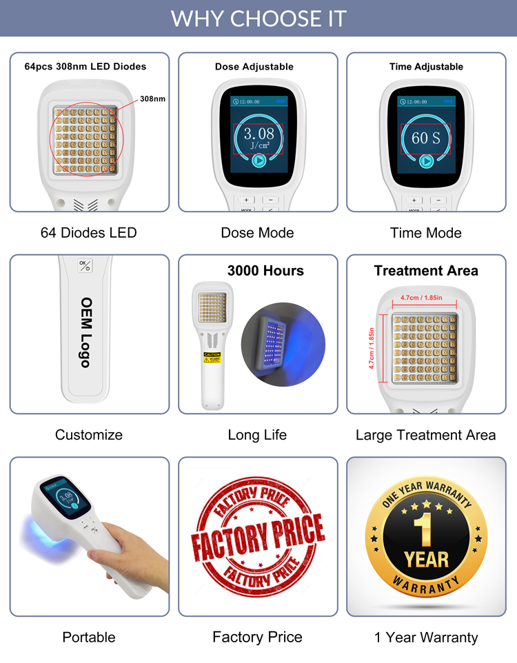 High costperformance effective laser excimer 308nm device for psoriasis vitiligo and eczema