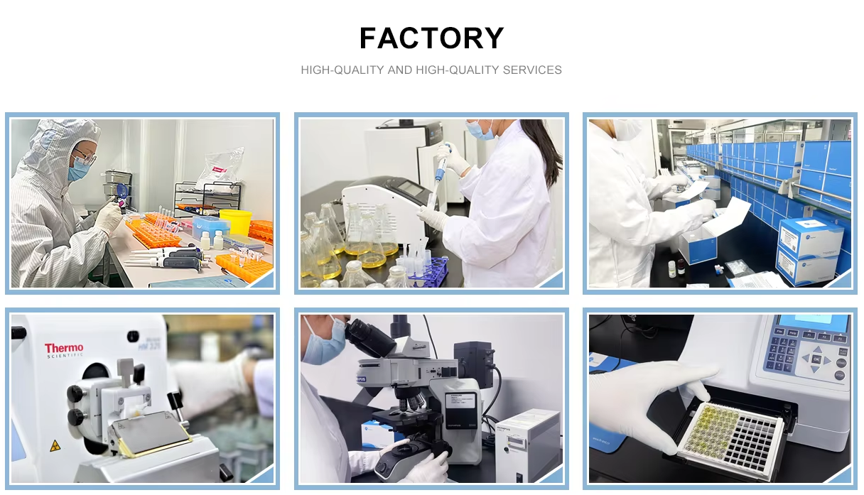 Human TNFATumor Necrosis Factor Alpha ELISA Kit
